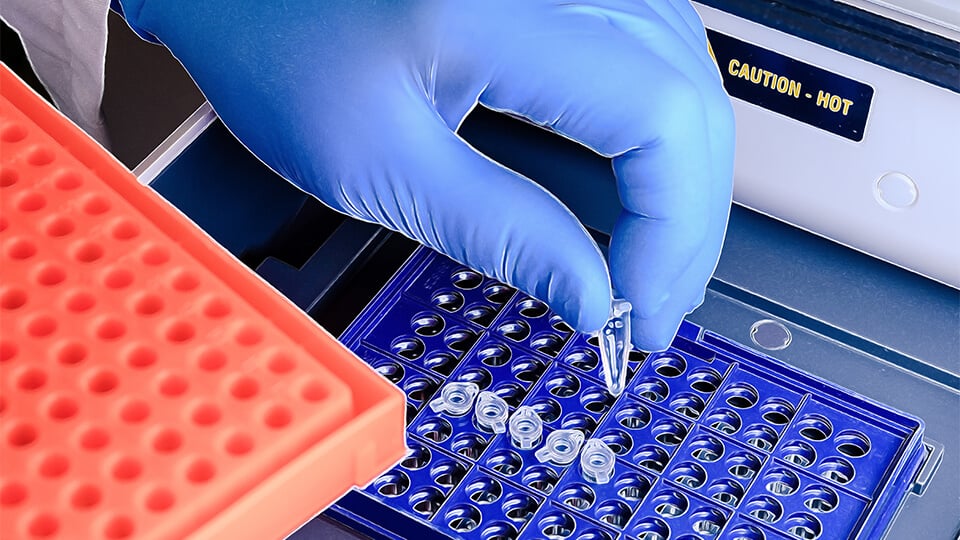 In Vitro Diagnostics Trends: Faster, Smarter, and More Personalized