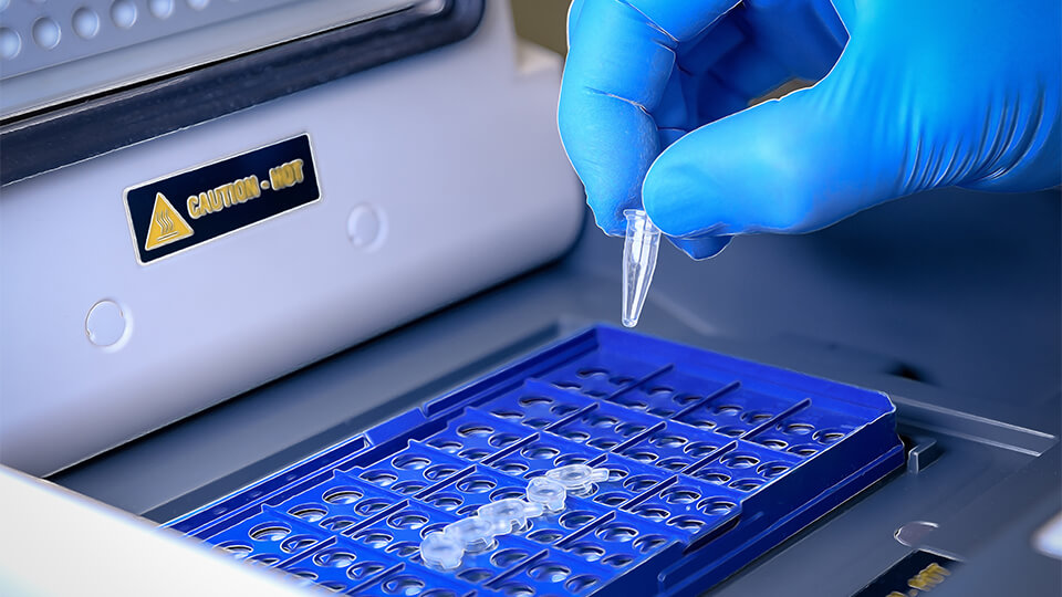 Application of Molecularly Imprinted Polymers in POC Diagnostics